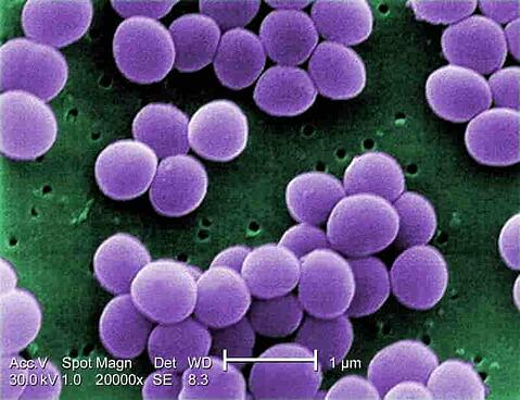 1280px-Staphylococcus_aureus_VISA_2