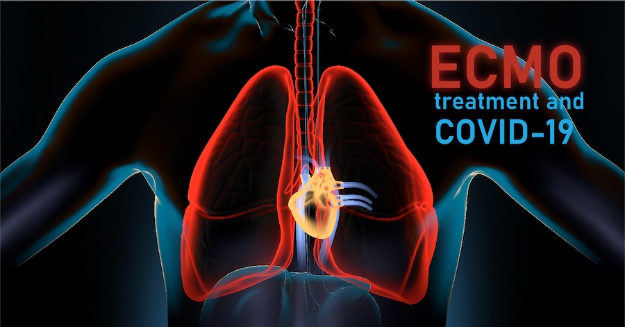 ECMO Treatment and COVID-19