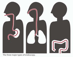 endoscopy types caption-01-01